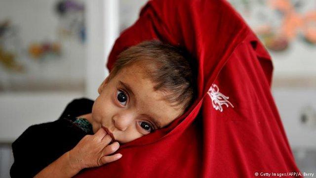 یونیسف: می توان جلوی مرگ 80 درصد نوزادان را گرفت یونیسف: می توان جلوی مرگ 80 درصد نوزادان را گرفت