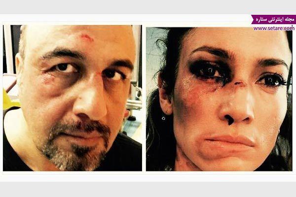 شوخی اینستاگرامی رضا عطاران با جنیفر لوپز